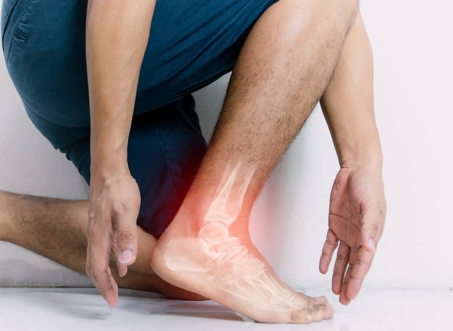 How to Avoid Ankle Arthritis After Ankle Sprains – Regenexx® at New  Regeneration Orthopedics