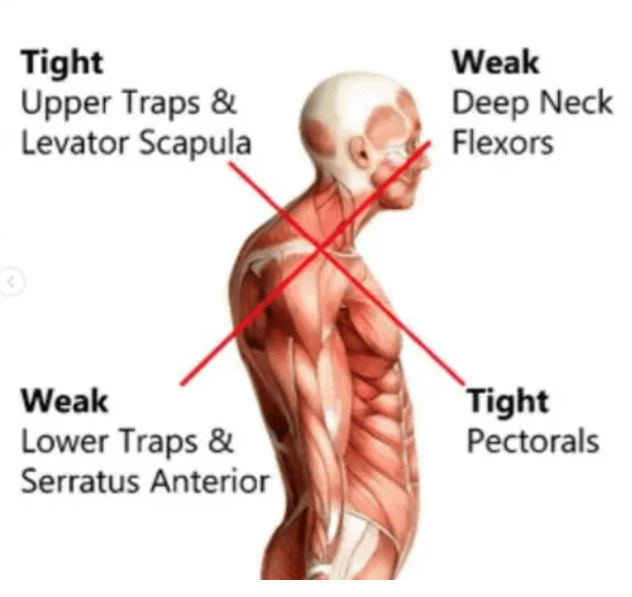 Is This Serious? Why Do My Shoulders Click, Crack Or Pop? - pt Health