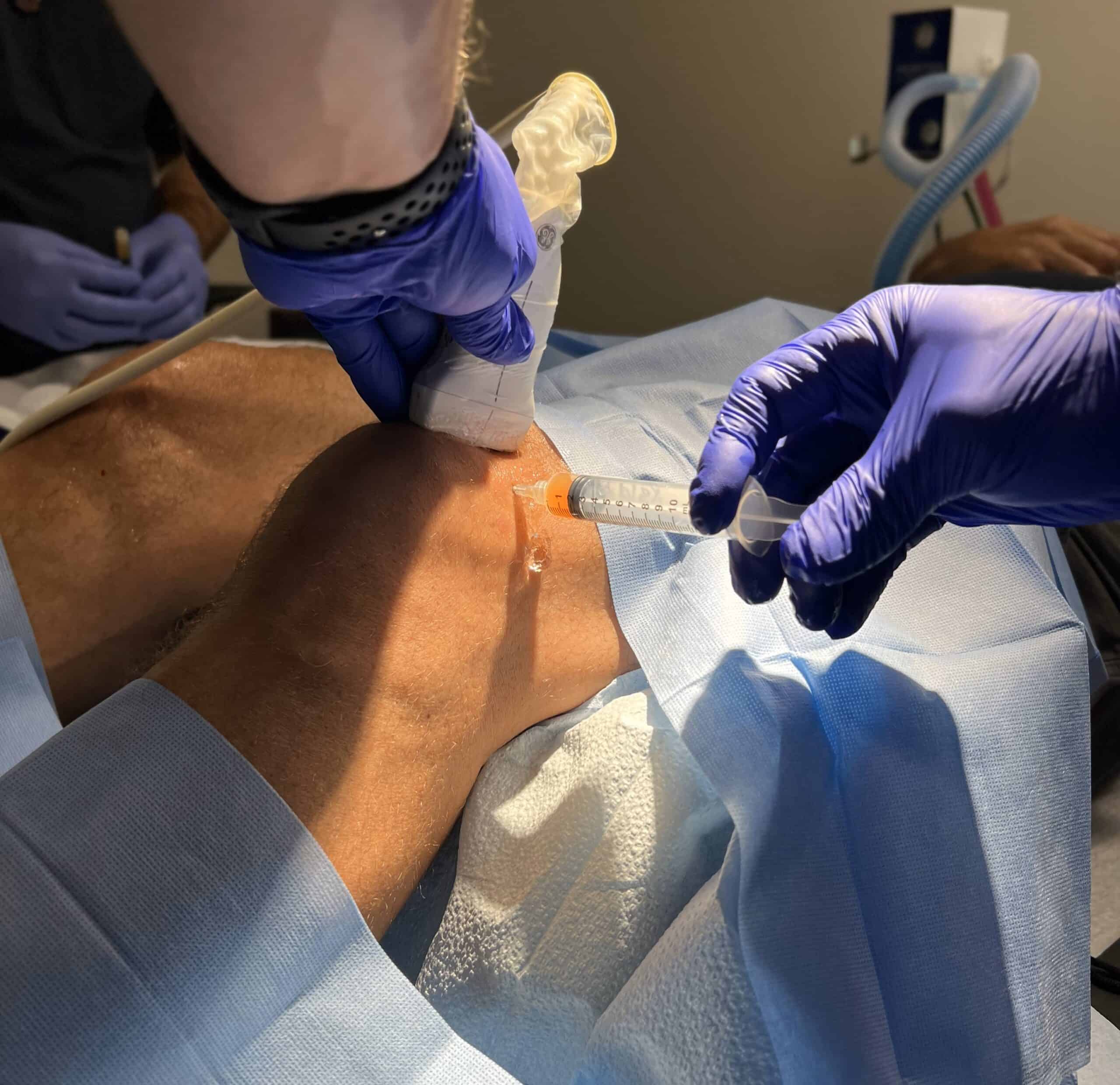 CAN AN INJECTION SAVE A PATIENT FROM ACL SURGERY? – Regenexx® at New  Regeneration Orthopedics
