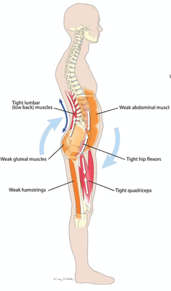 Tightness on best sale lower back