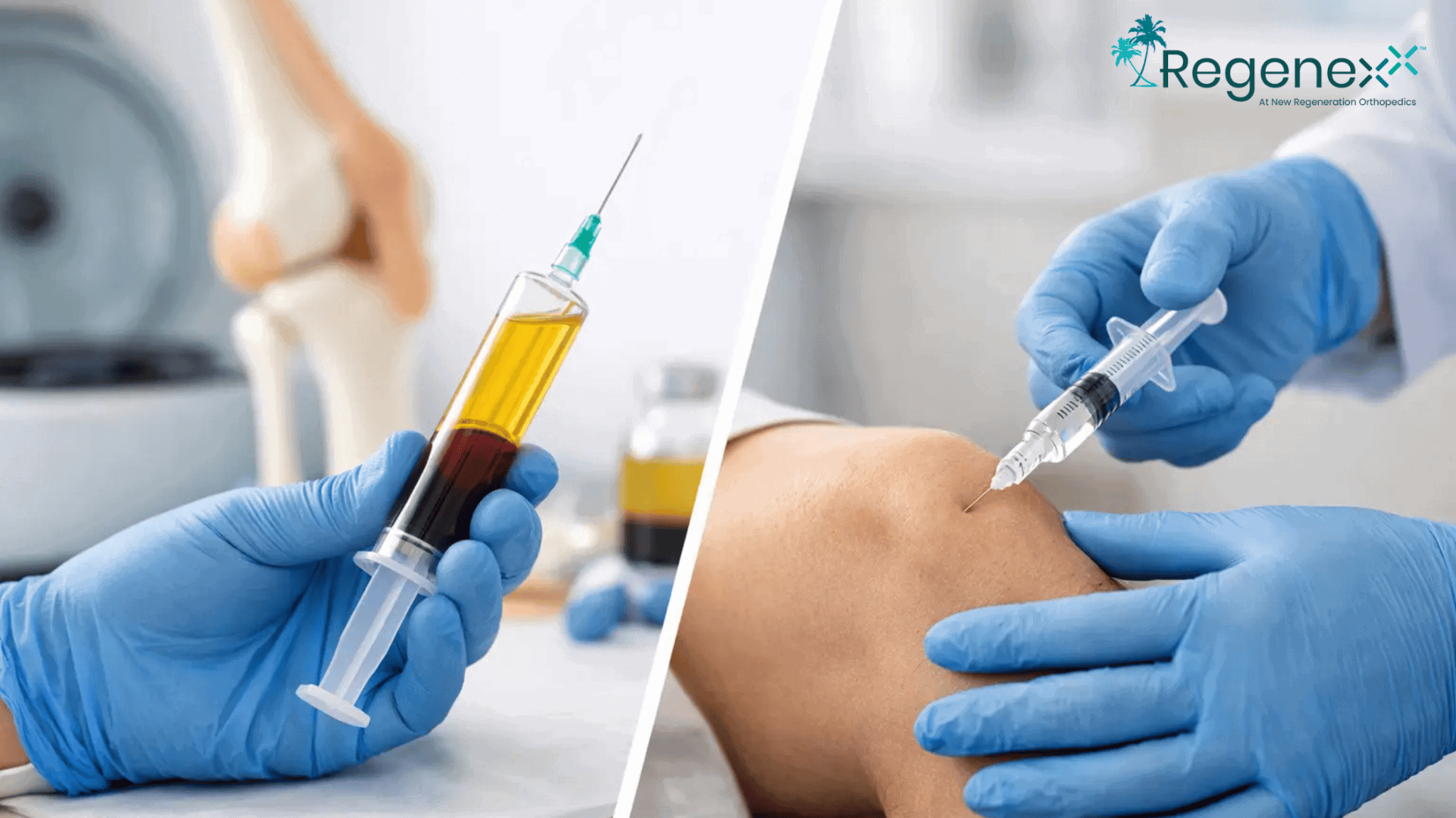 bpc-157 legal status poland The Hidden Risks of BPC‑157: What Patients Need to Know About Contamination and Safety B12: why choose an Vitruvias QTY:25 Vials